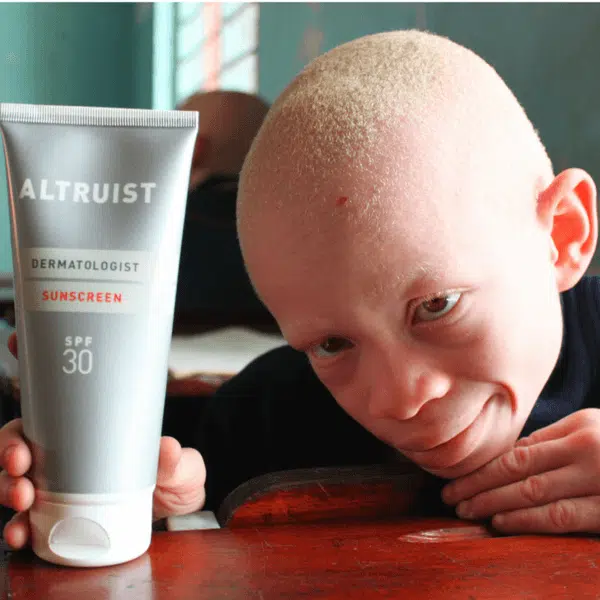 African albino boy holding protective sunscreen